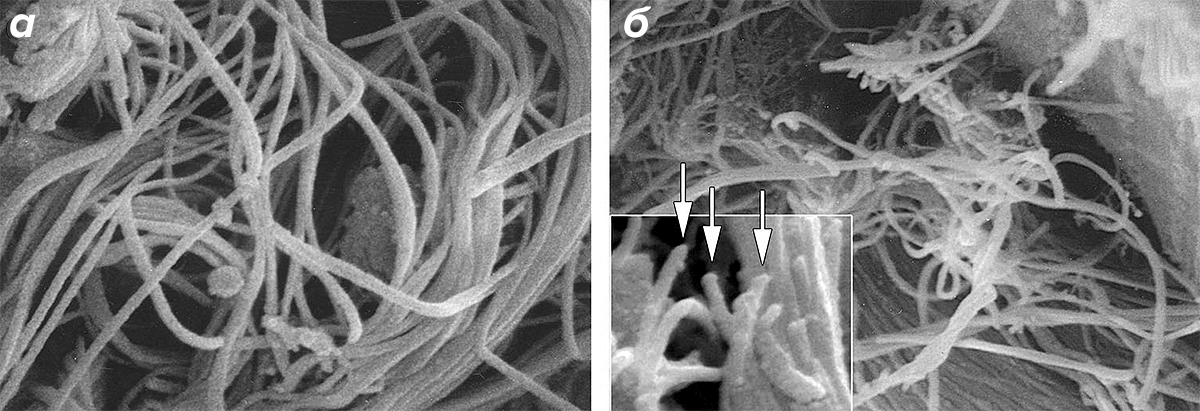Микрофотография коллагеновых нитей в коже