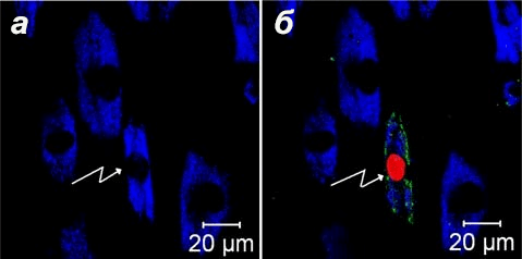 Лазерное воздействие на стволовую клетку