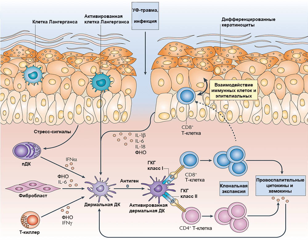 Работа клеток иммунной системы при псориазе