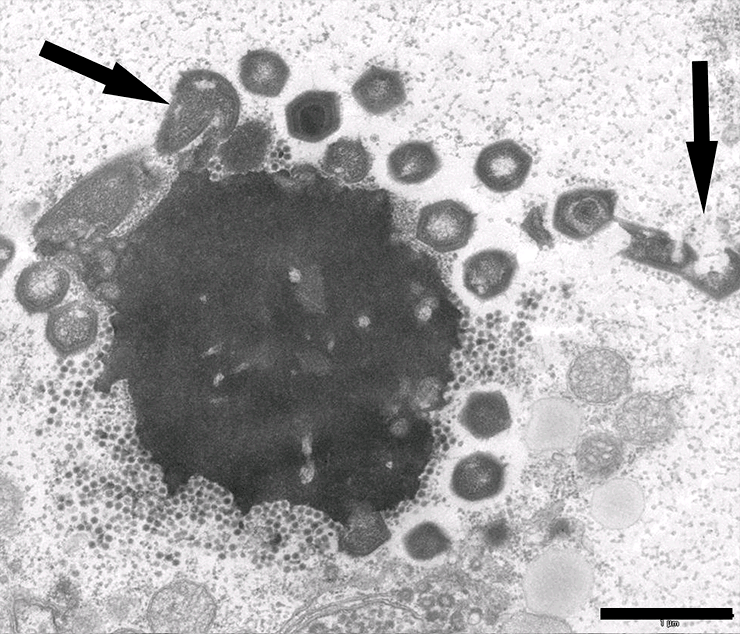 Вирусная фабрика в клетке амёбы, зараженной мимивирусом и вирофагом Замилон