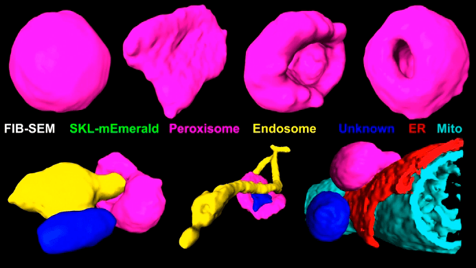 Варианты форм пероксисом и эндосом