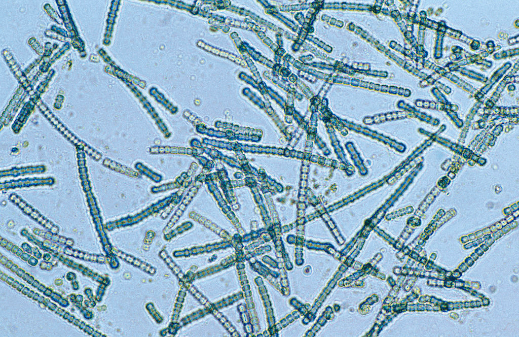 Многоклеточные цианобактерии Cylindrospermum sp.