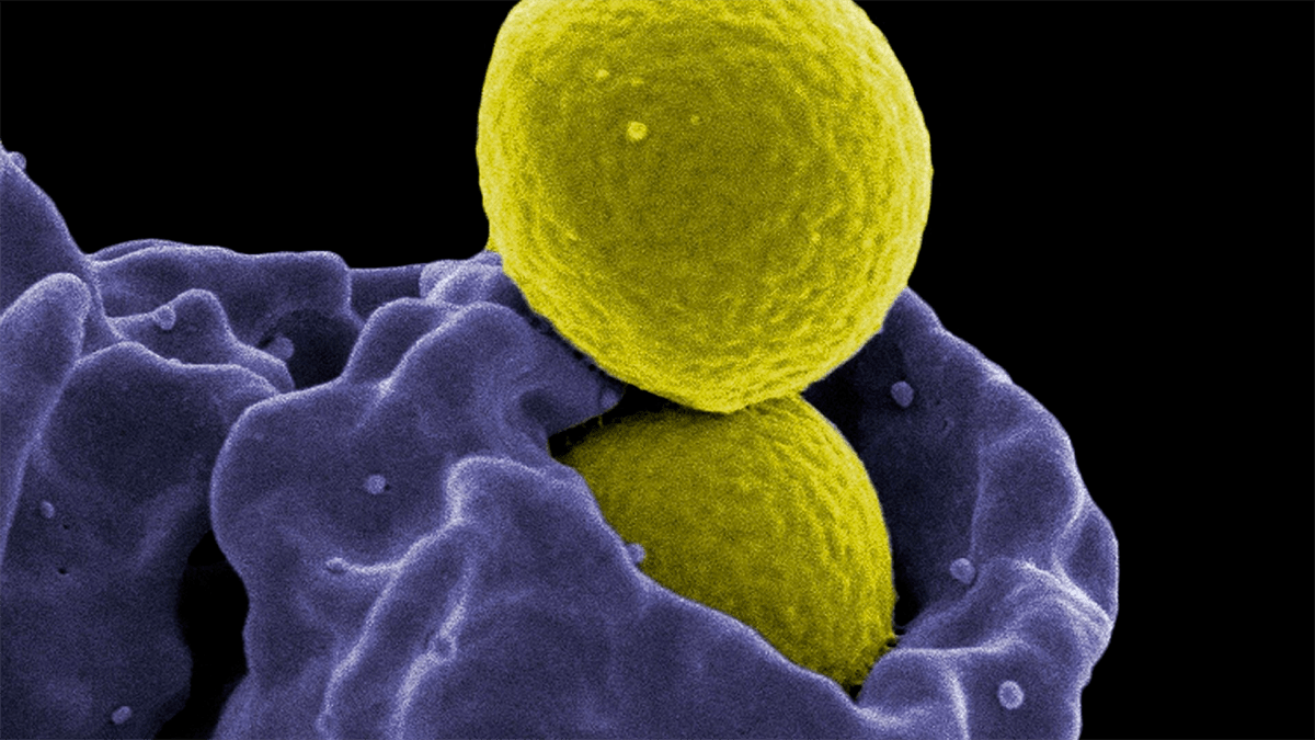 Нейтрофил обезвреживает метициллин-резистентную бактерию