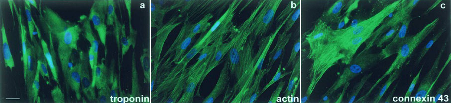 Дифференцировка мезенхимальных стволовых клеток эндометриального происхождения в кардиомиоциты