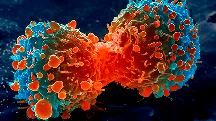 Пролиферация раковых клеток легкого