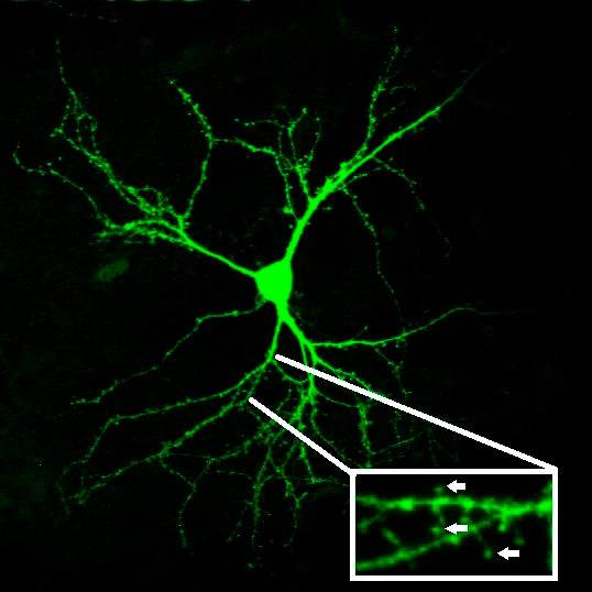Дендритные шипики на поверхности стриатного нейрона