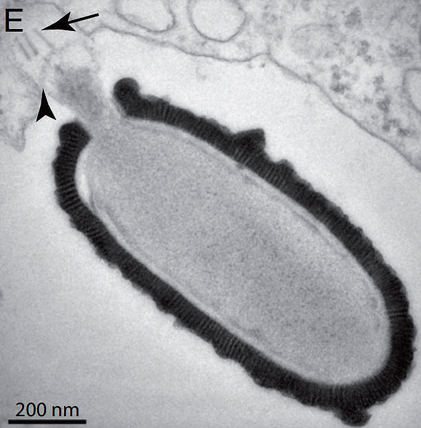 Электронная микрофотография питовируса