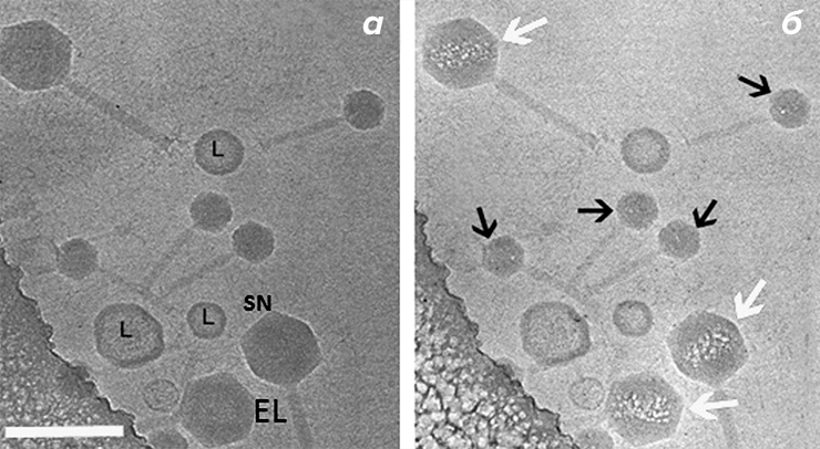 Визуализация внутреннего тела в капсиде бактериофага EL