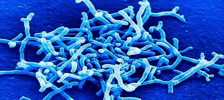 Bifidobacterium breve