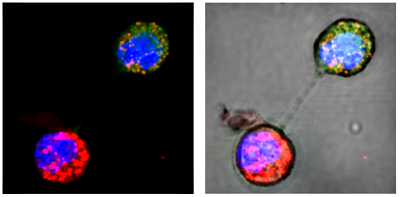 Перенос митохондриальной ДНК в раковую клетку