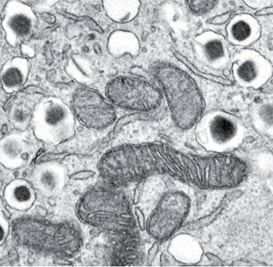 Микрофотография цитоплазмы β-клетки