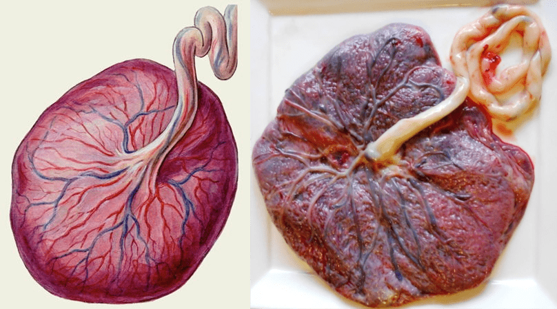Плацента