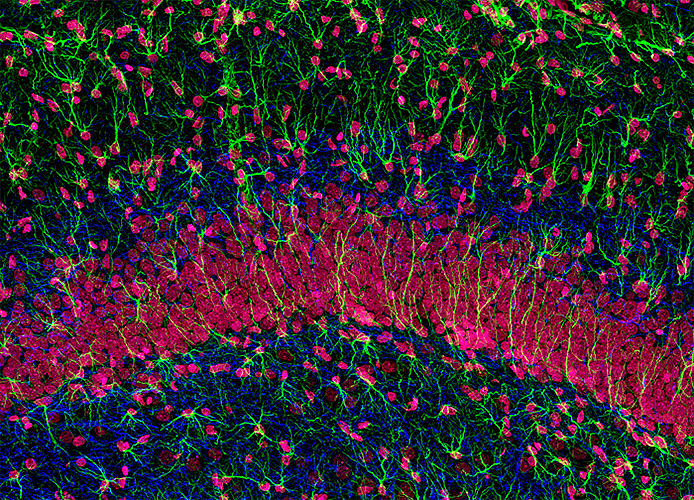 Гиппокампальные нейроны