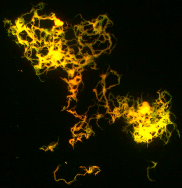 Культура микобактерий под люминесцентным микроскопом