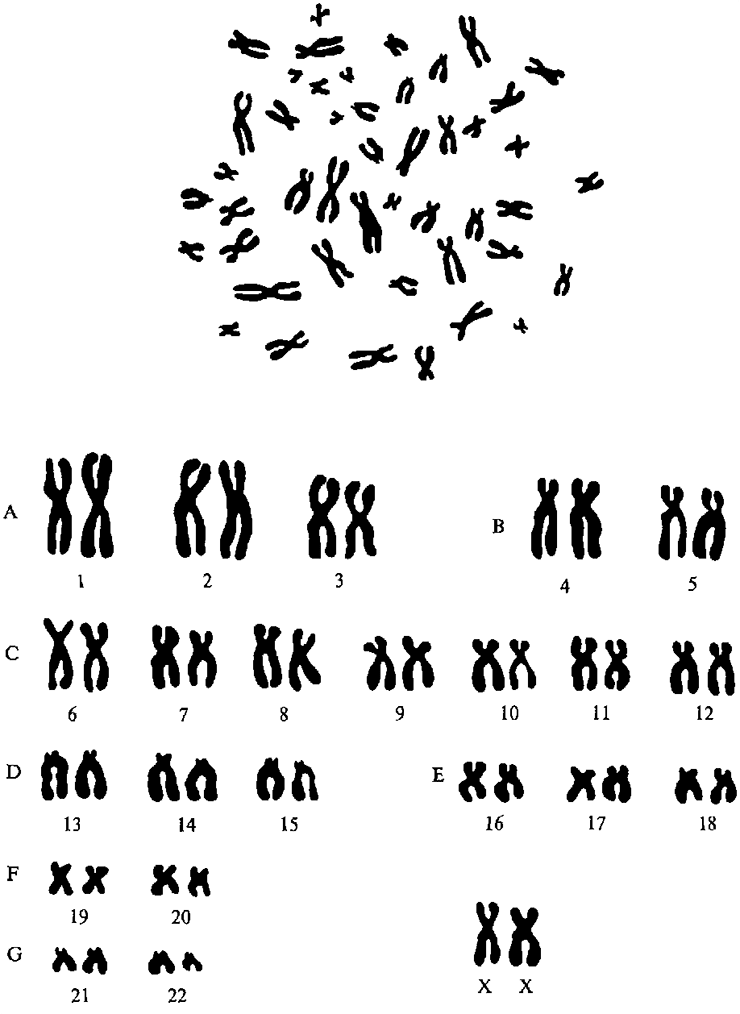 Распределение хромосом по группам согласно Денверской классификации