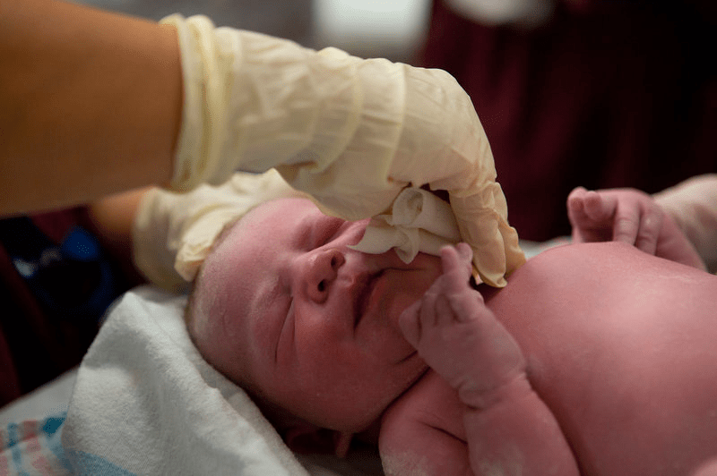 Новорожденную смазывают вагианальной жидкостью матери
