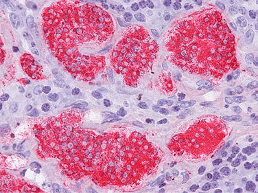 Раковые клетки, происходящие из Hymenolepis nana