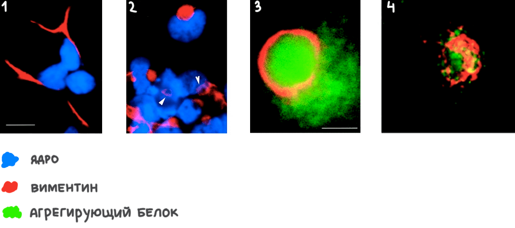 Фотографии клеток, полученные с помощью флуоресцентного микроскопа