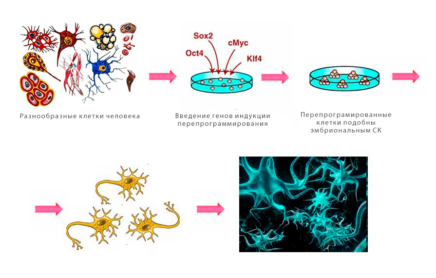 Процесс превращения клеток человеческих тканей в нейроны