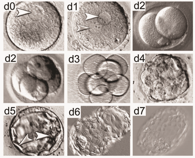 Этапы предимплантационного развития эмбриона человека