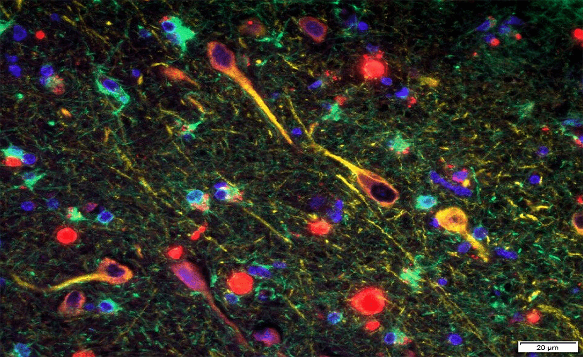 Экземпляр мозговой ткани одного из исследуемых образцов