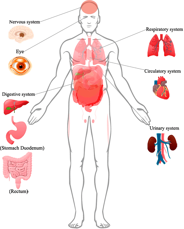 Поражения органов у пациентов с COVID-19