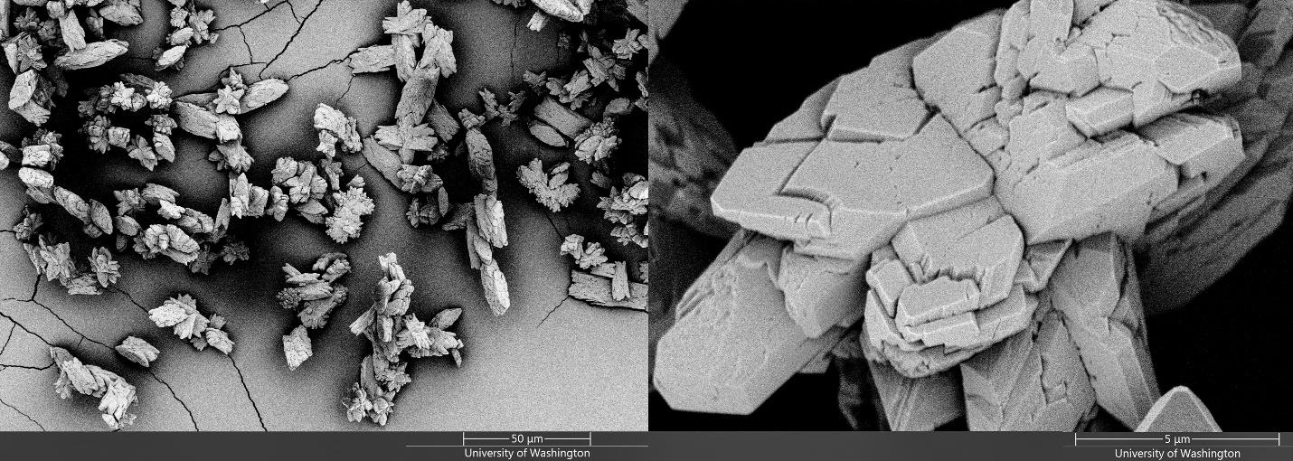 Сканирующие электронные микрофотографии микрокристаллов оксалата кальция