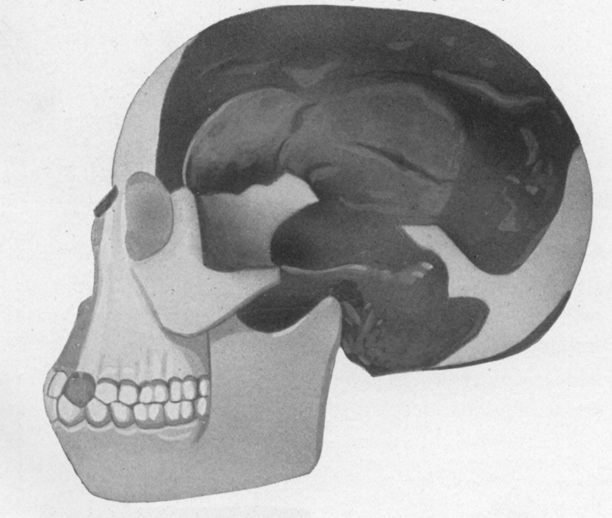 Реконструкция черепа «пилтдаунского человека»