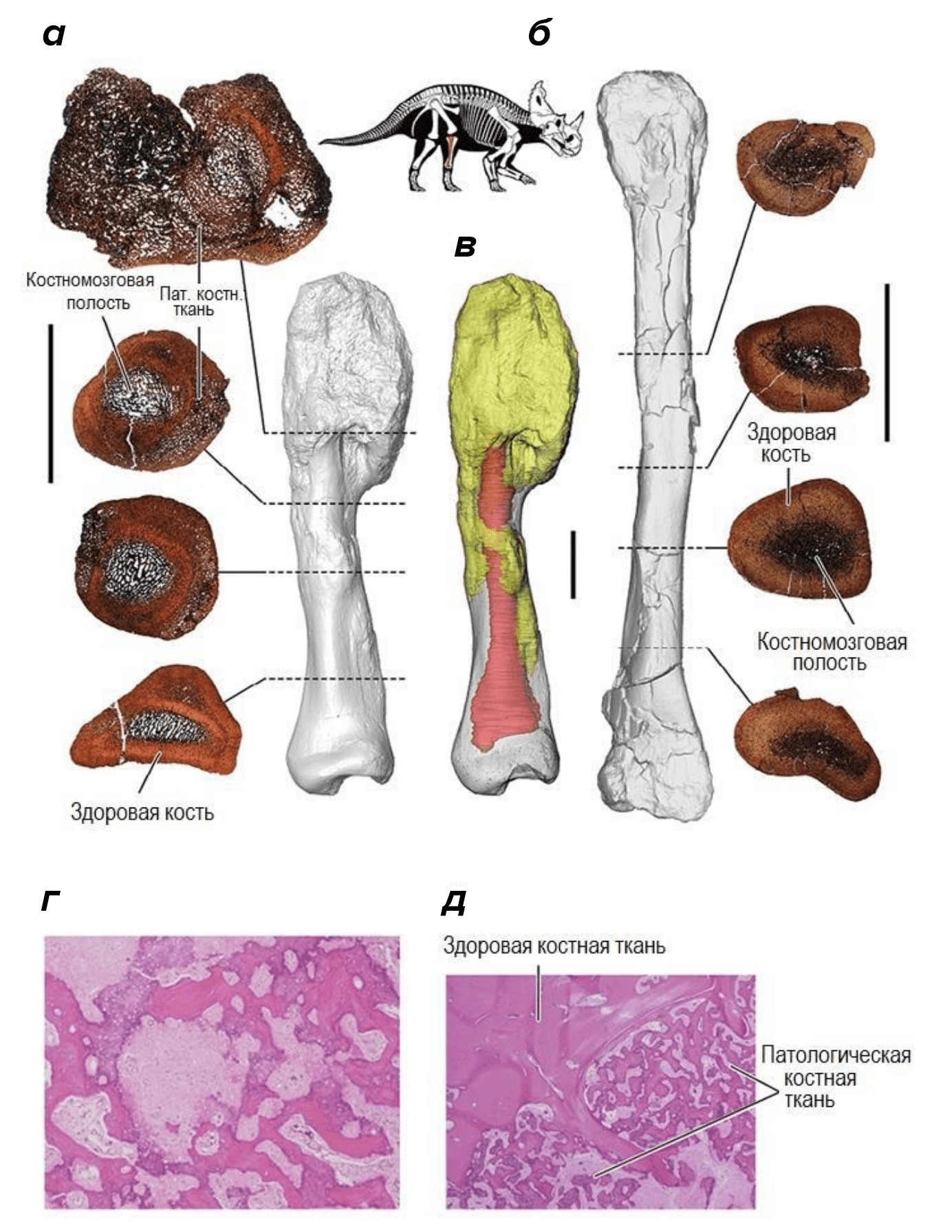 Гистологический анализ остеосаркомы у центрозавров и человека