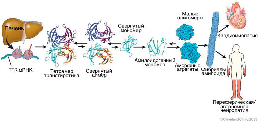 Молекулярный путь развития ATTR-амилоидоза