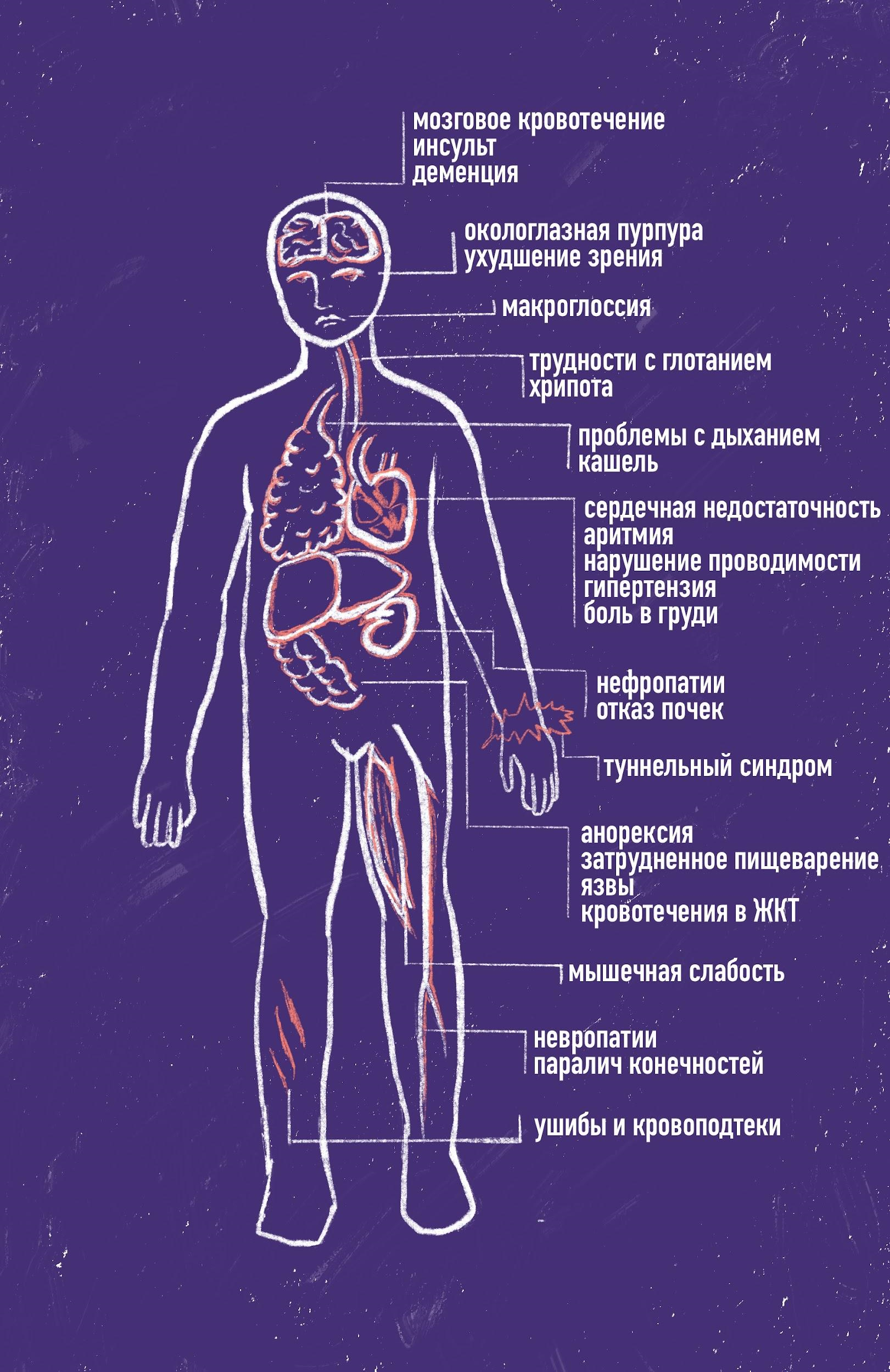 Симптомы ATTR-амилоидоза в разных органах и системах органов