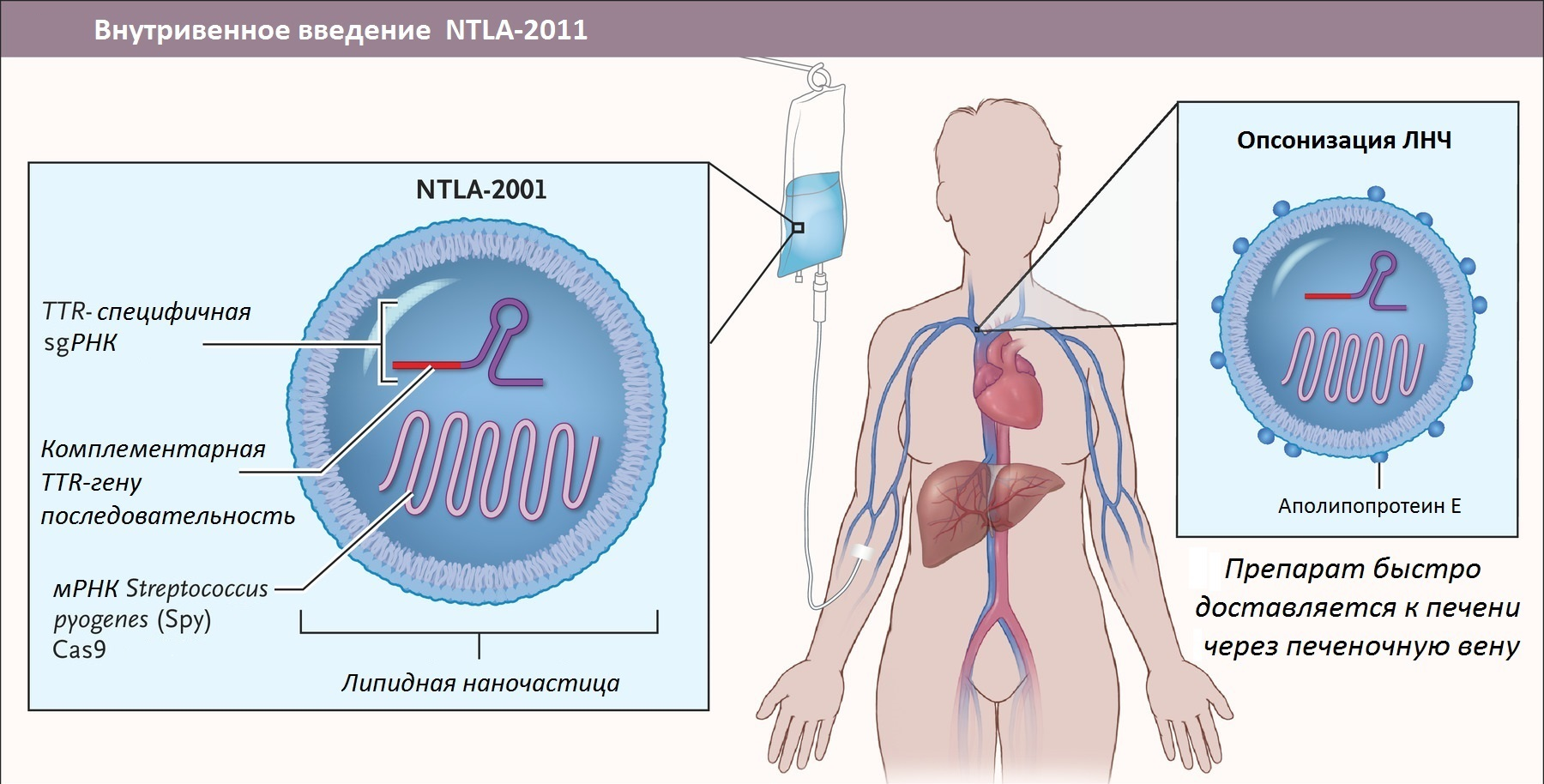 Основные компоненты NTLA-2001 — препарата для генной терапии ATTR-амилоидоза