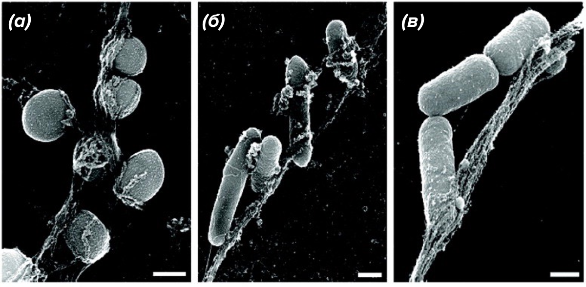 Разные бактерии, захваченные NETs