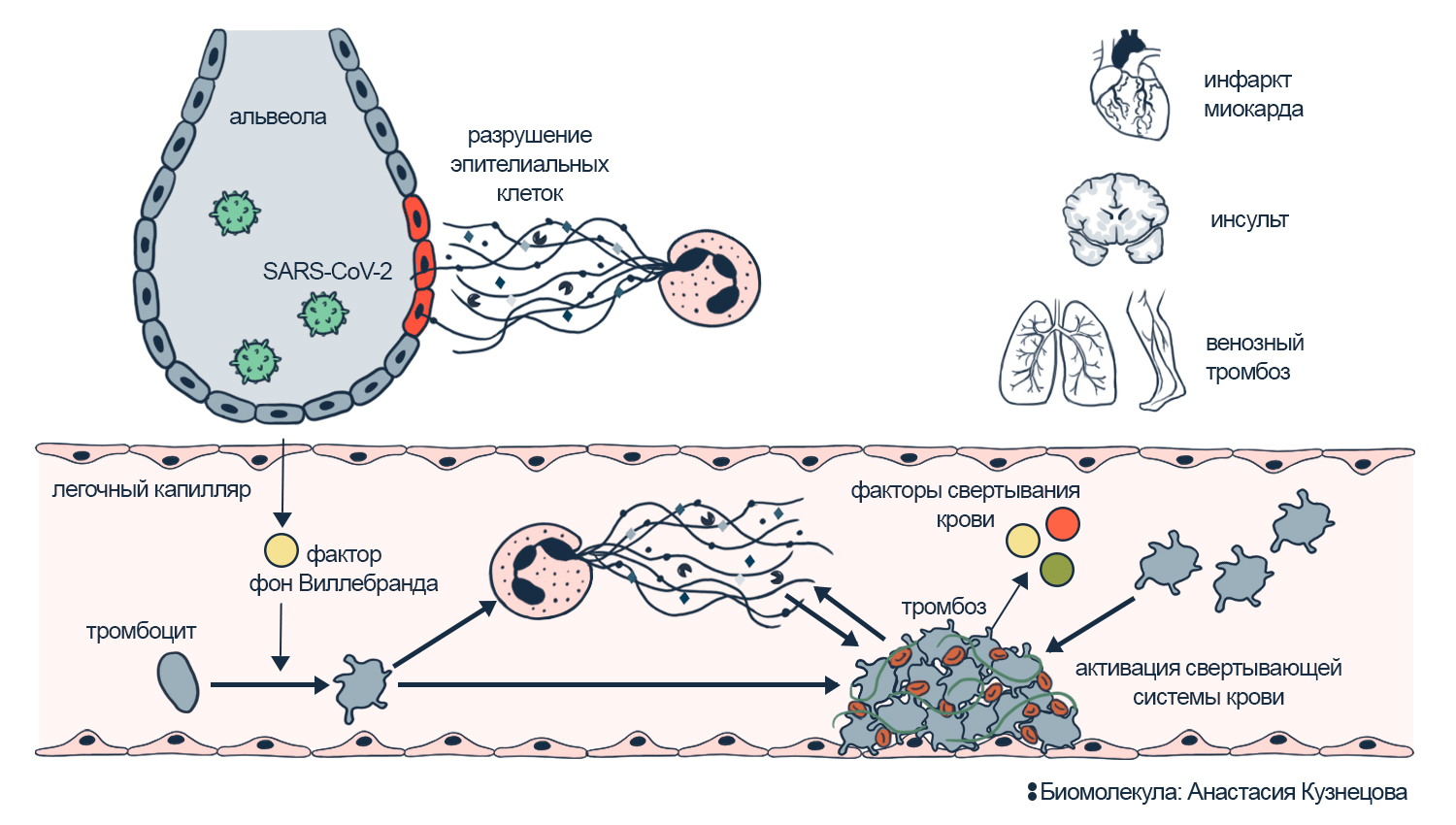 Взаимосвязь нетоза, иммунотромбоза и легочной недостаточности при COVID-19