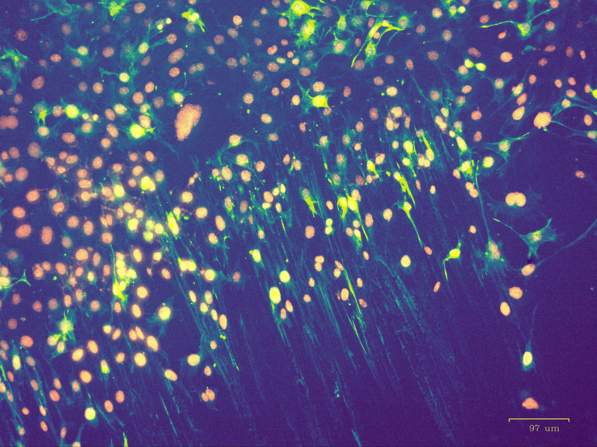 Флуоресцентная микроскопия