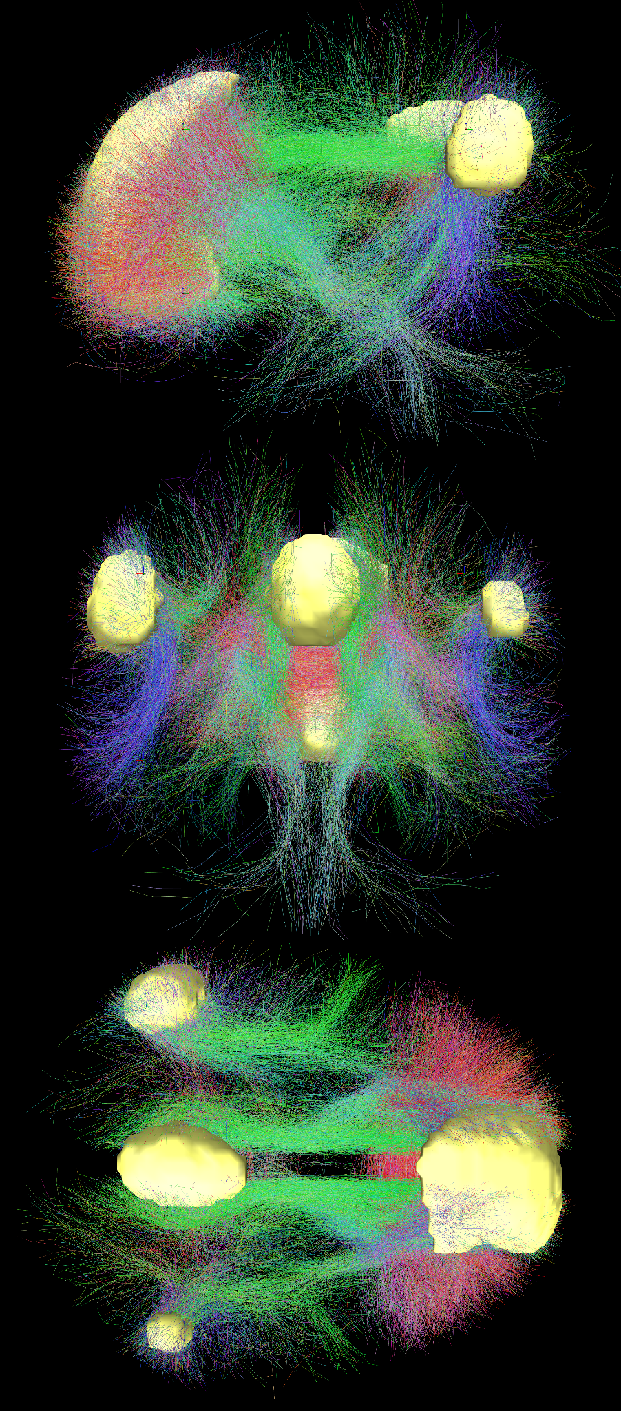 Визуализация коннектома между главными функциональными центрами сети по умолчанию в мозге человека