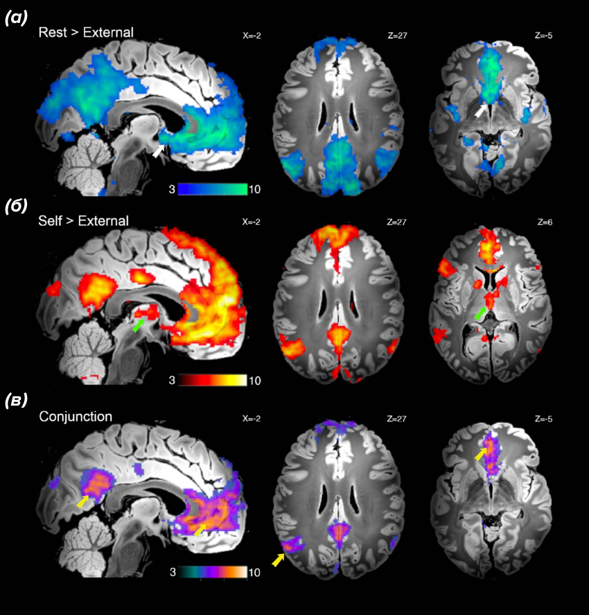 Карты активности фМРТ мозга при различных состояниях