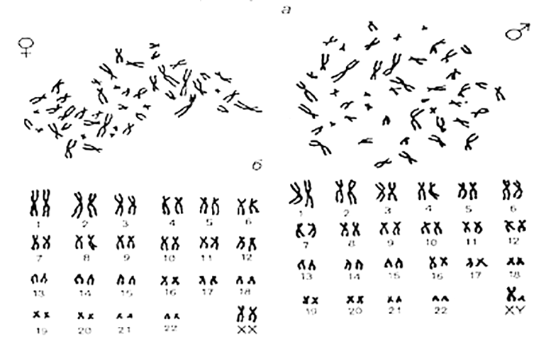 Хромосомы — сложные молекулярные комплексы ядра клетки, состоящие из ДНК и белков