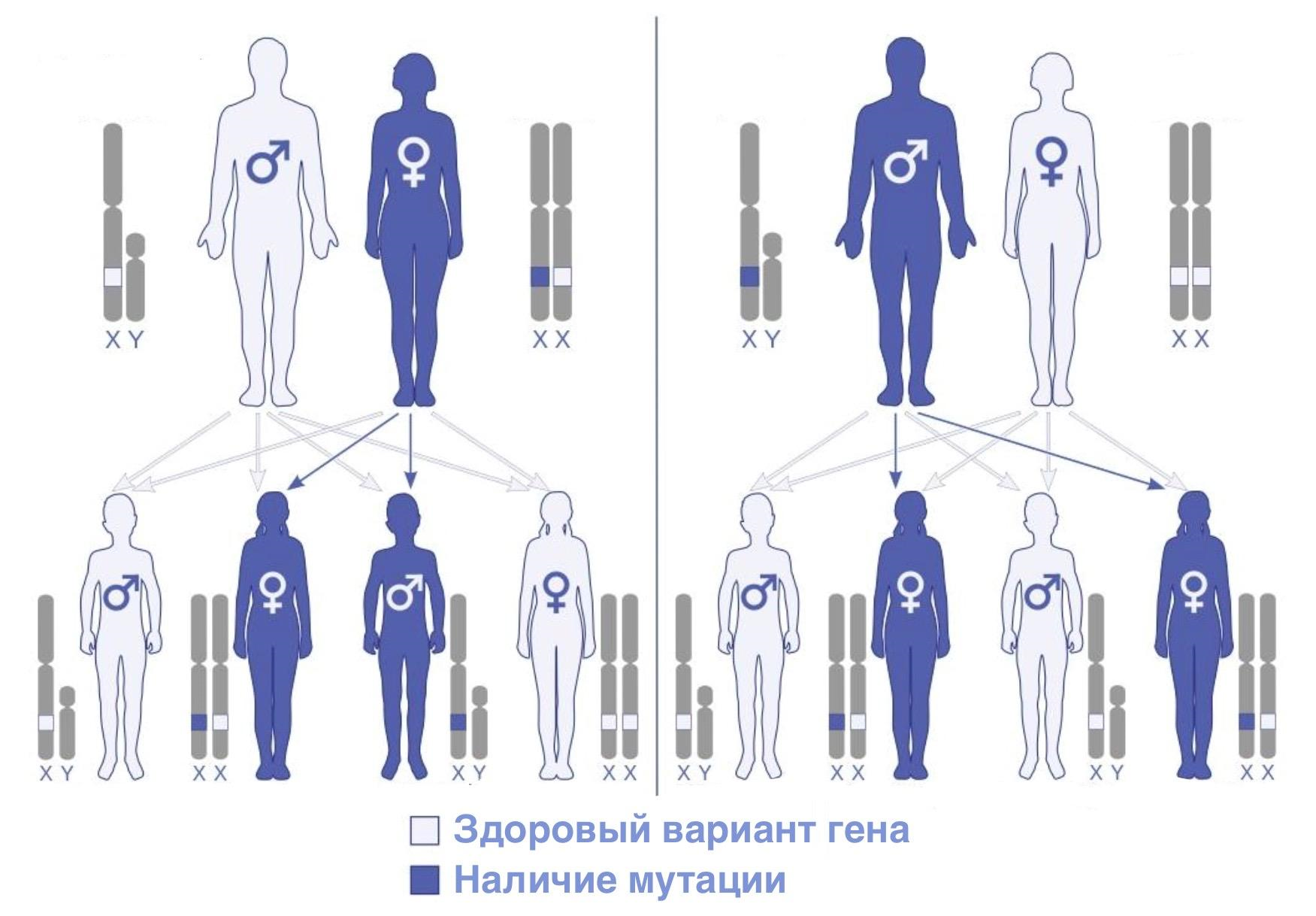 Схема Х-сцепленной передачи гена, отвечающего за развитие болезни Фабри