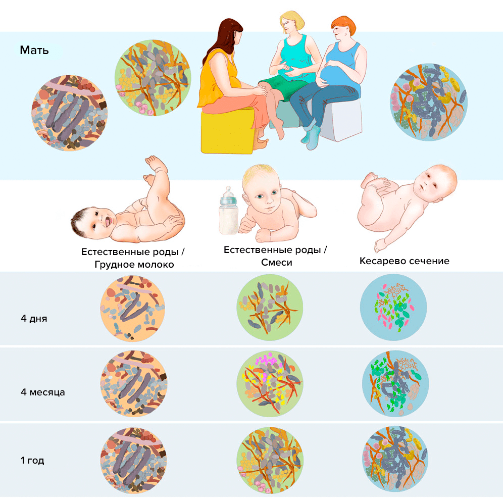 Изменение микробиоты младенцев в зависимости от способа родоразрешения и кормления