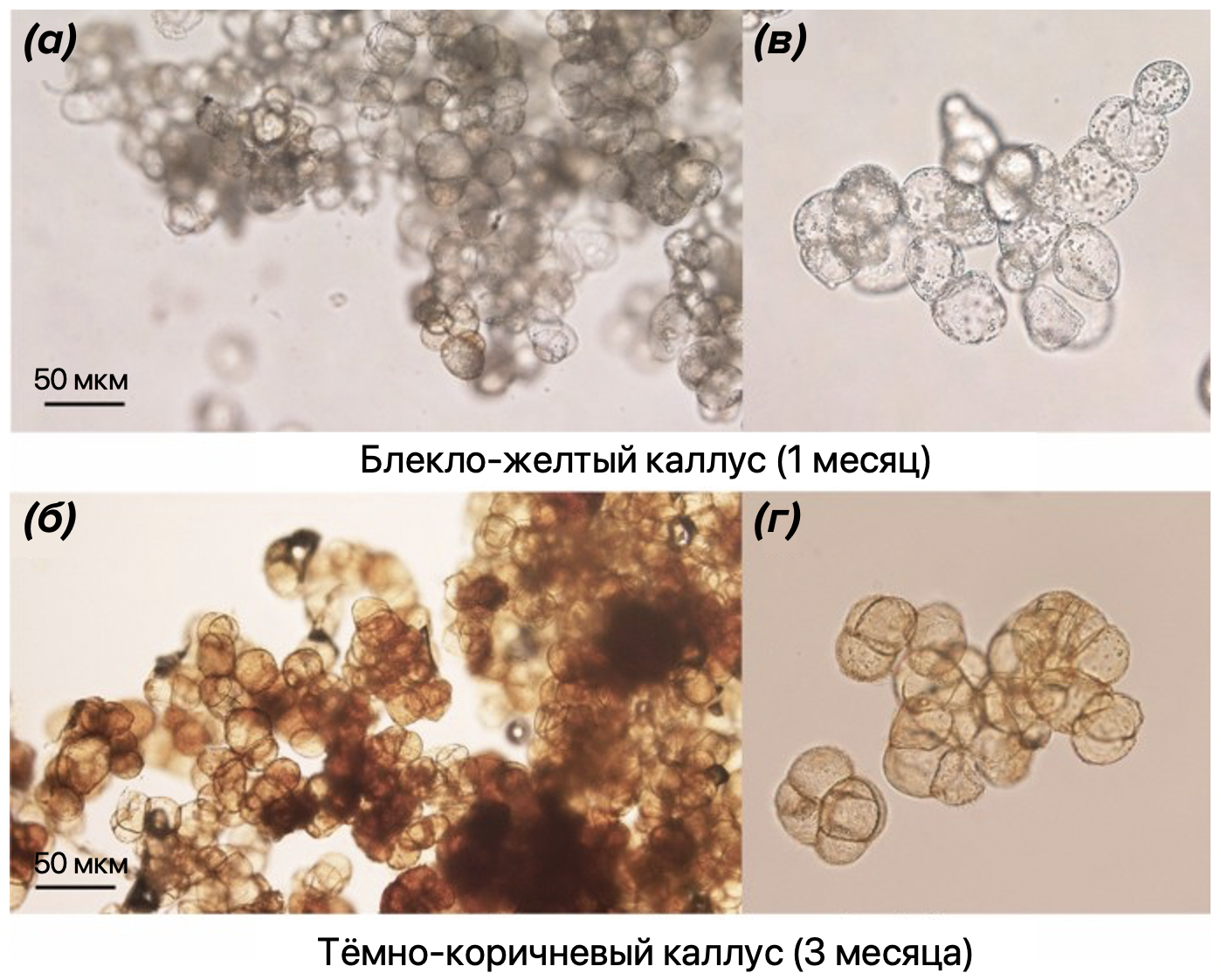 Микроскопия желтых и темно-коричневых каллусов