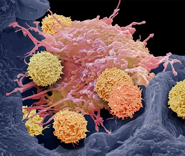 Раскрашенная сканирующая электронная микрофотография Т-клеток