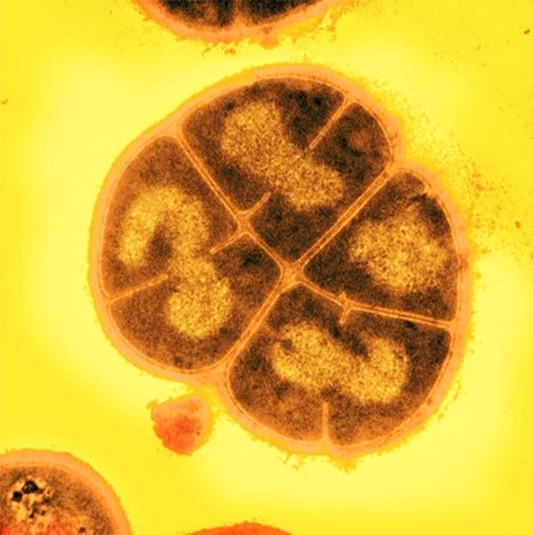 Deinococcus radiodurans — бактерия, устойчивая к радиации