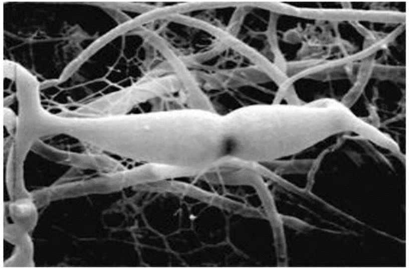 Бесцветные гифы гриба — одна многоядерная разветвленная клетка (синцитий)