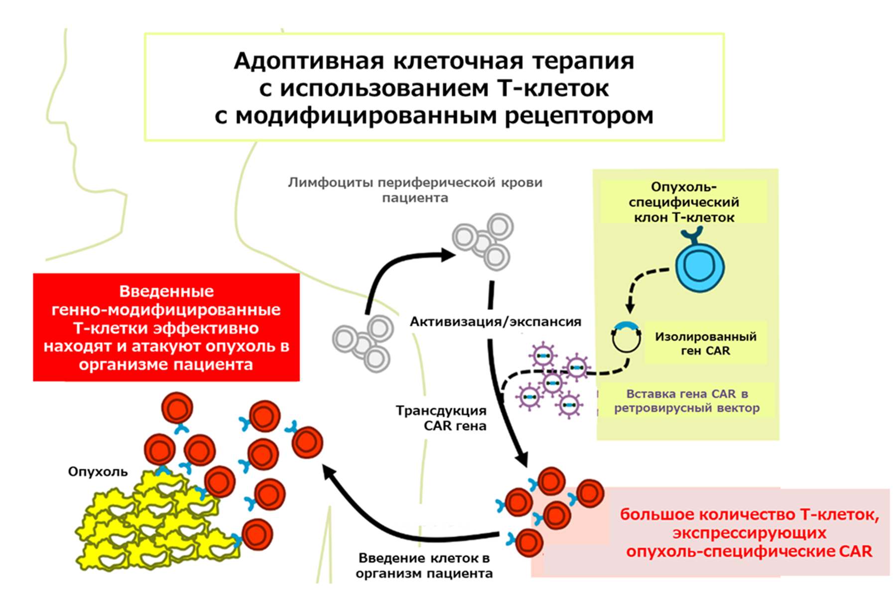 Общая схема иммунотерапии модифицированными лимфоцитами