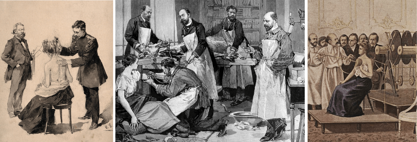 Методы «лечения» туберкулеза в конце XIX начале ХХ века