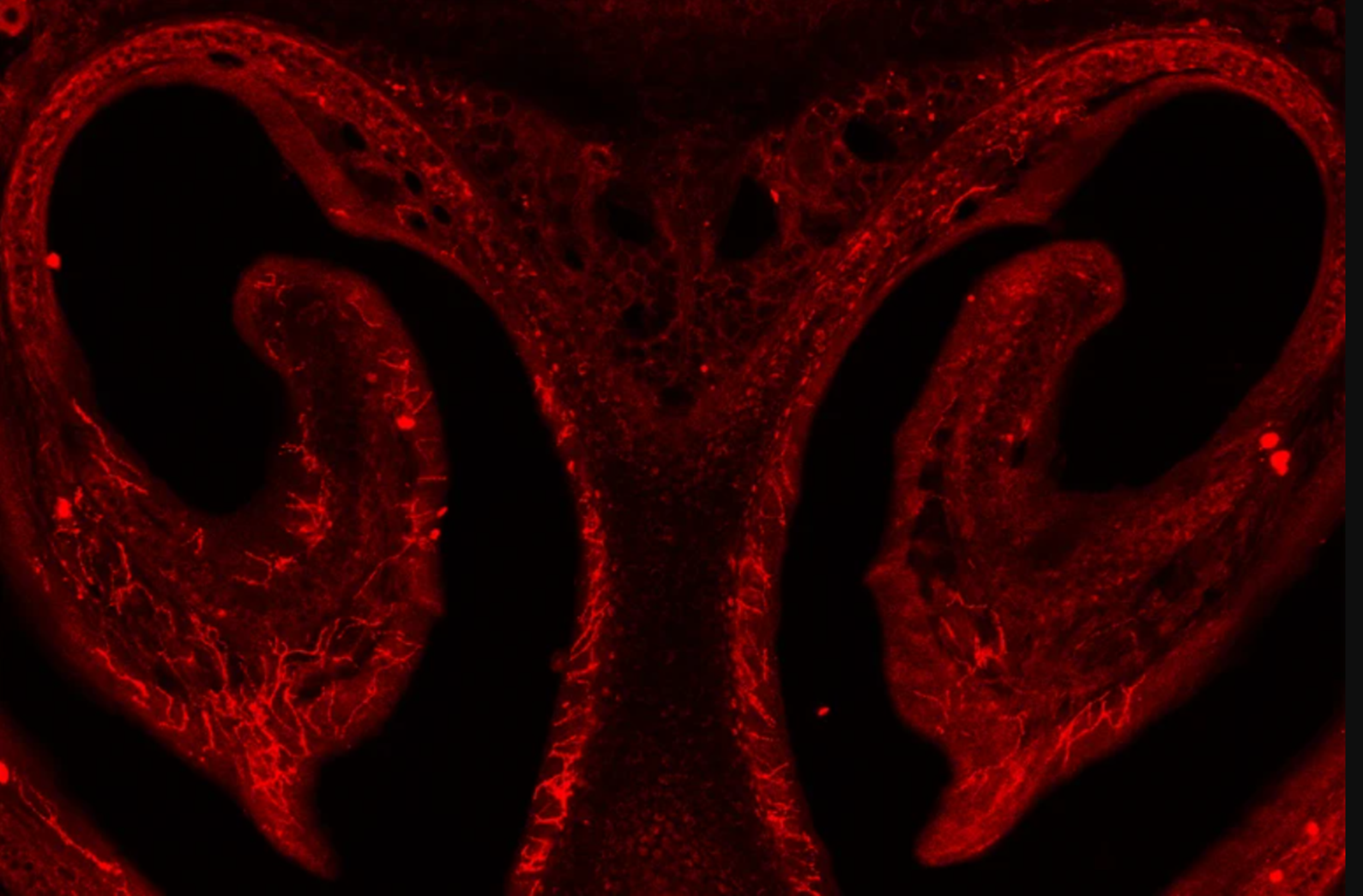 Чихательные нейроны (Sneeze neurons) в носовых ходах мыши