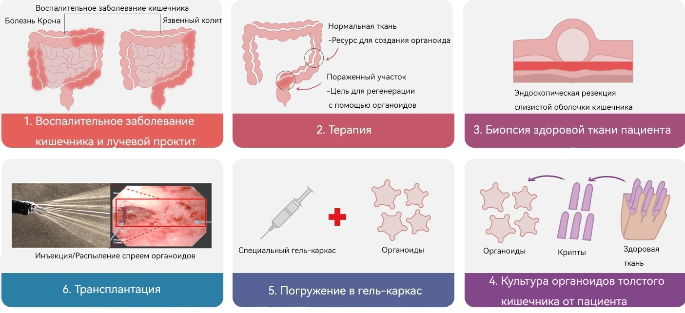 Схематическое представление технологии регенерации эпителия кишечника с помощью органоидов