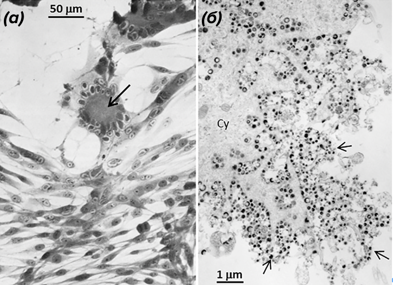 Микрофотографии монослоя клеток, инфицированных in vitro вирусом ветряной оспы