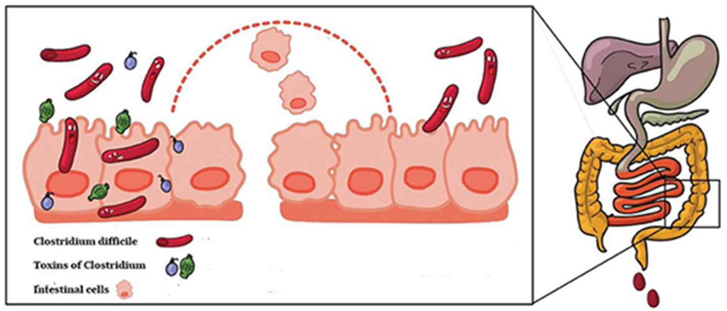 Споры Clostridioides difficile